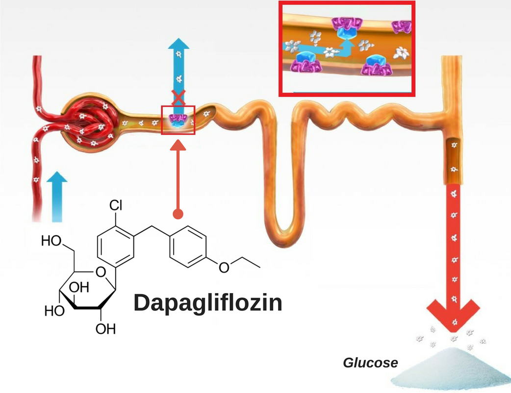 Dapagliflozin Launched In Pakistan - Fever.pk Dapagliflozin In Pakistan