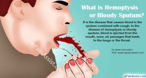 persistent cough with mucus